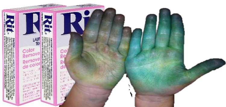 Use Professional Products to Get Fabric Dye off Skin